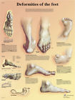 12-4601l Fabrication Enterprises Anatomical Chart Deformities Of The Feet 4053083005673