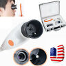 190891551504 Unbranded Usb Iriscope Iris Analyzer Iridology Camera Pupilometer