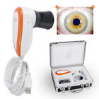 190891907615 Carejoy Profession Usb Iriscope Iris Analyzer Iridology Led
