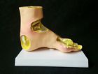 1985 Gpi Gout Anatomical Foot Model