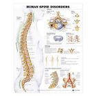 Eec45201 Elite Medical Instruments Human Spine Disorders Anatomical Chart