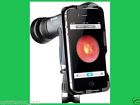 11840 Mobile Allyn Welch Digital Imaging Device Iexaminer Adapter
