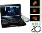 Rus-9000v Carejoy Vet Portable Ultrasound Scanner Transducer Veterinary Sale 190891381071