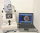 Trc-nw100 Tr-nw100 Topcon Digital Retinal Camera