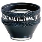 Vcrlvitssv Volk Central Retinal Ssv