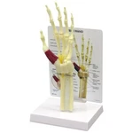 Hand Wrist Carpal Tunnel Syndrome Anatomical Model Gpi Lfa #1920VIDEO Make Offer. Fixed Price $99.75.