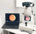 Topcon Trc NW8 Non-mydriatic Fundus Retinal Camera Nikon D90. Tested. Fixed Price $1679.30.