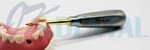 Dental Bernard Spade Elevator Surgical Extraction Straight Gold Tip. Fixed Price $35.00.