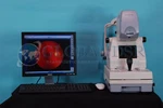 Topcon Trc NW200 Non Mydriatic Retinal Fundus Camera W/ Imagenet. Fixed Price $6450.00.