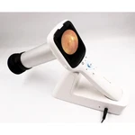 New Portable Handheld Digital Fundus Camera. 45 Deg Lens Included, 2 Mpx Res.. Fixed Price $4135.00.