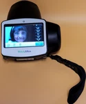 Welch Allyn VS100 Spot Vision Screener Autorefractor. Fixed Price $4995.00.